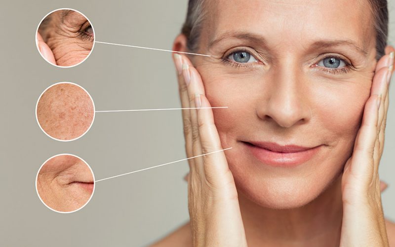 Reducing wrinkles with CBD